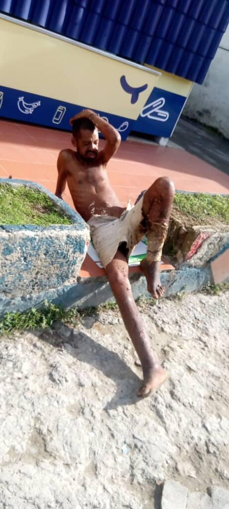 Hombre sentado con barro en exterior