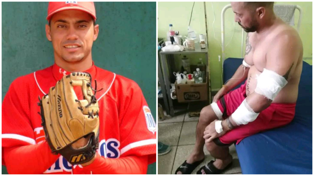 Jugador de béisbol sonriente; hombre con vendajes sentado.