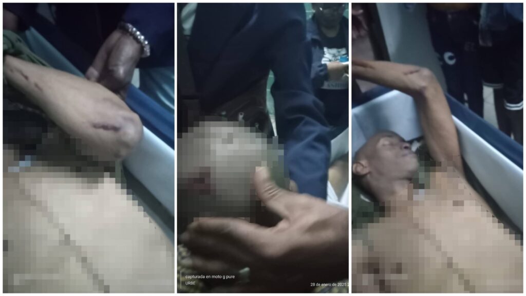 Hombre siendo atendido en transporte público