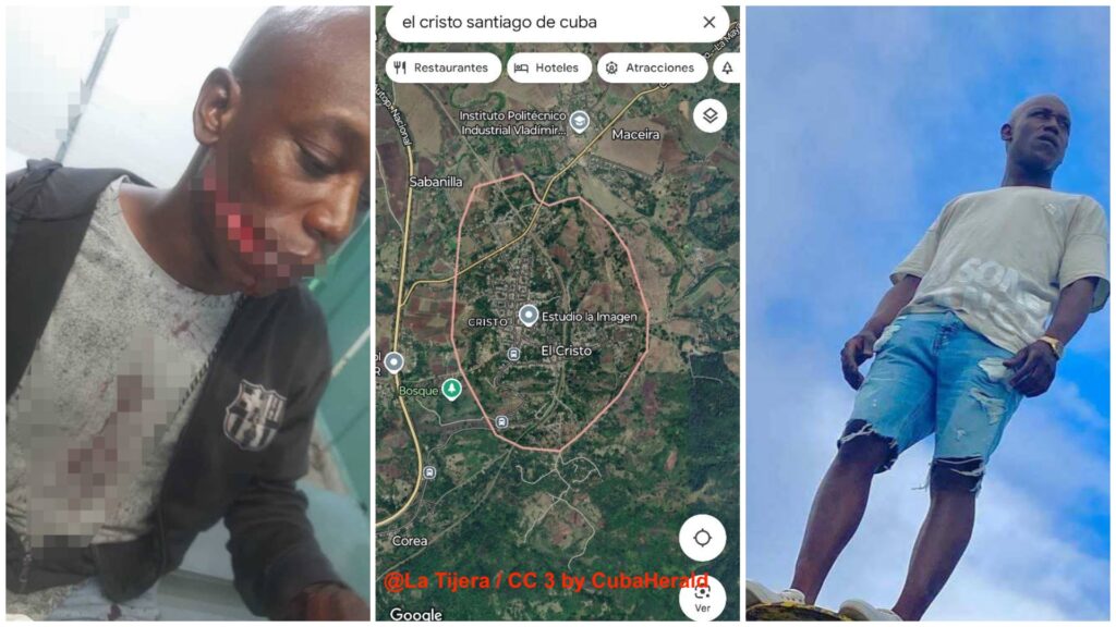 Collage: persona herida, mapa y joven posando