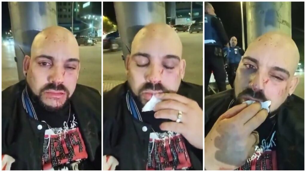 Hombre herido en la calle con policías cercanos.