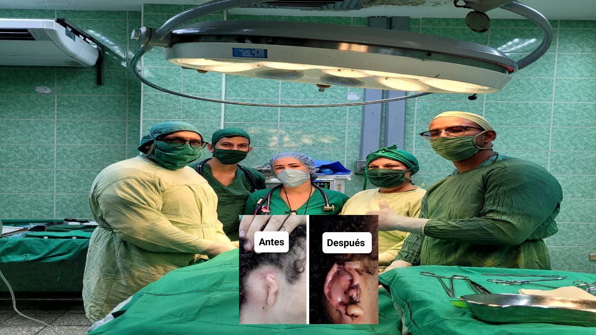 Equipo médico en quirófano con cirugía antes y después