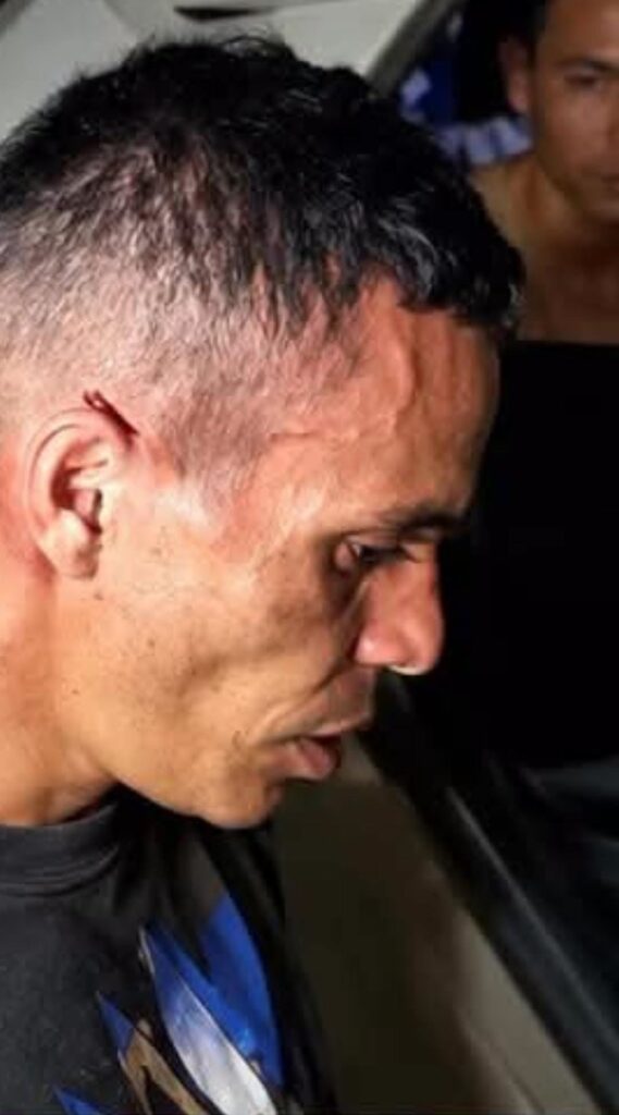 Primer plano de un hombre con una herida en la oreja.